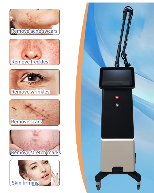 CO2 fractional laser machine for skin resurfacing. - HUIMAIN