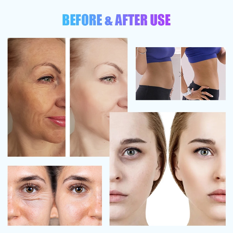 Imágenes comparativas de antes y después que muestran resultados de cuidado de la piel y pérdida de peso. - HUIMAIN