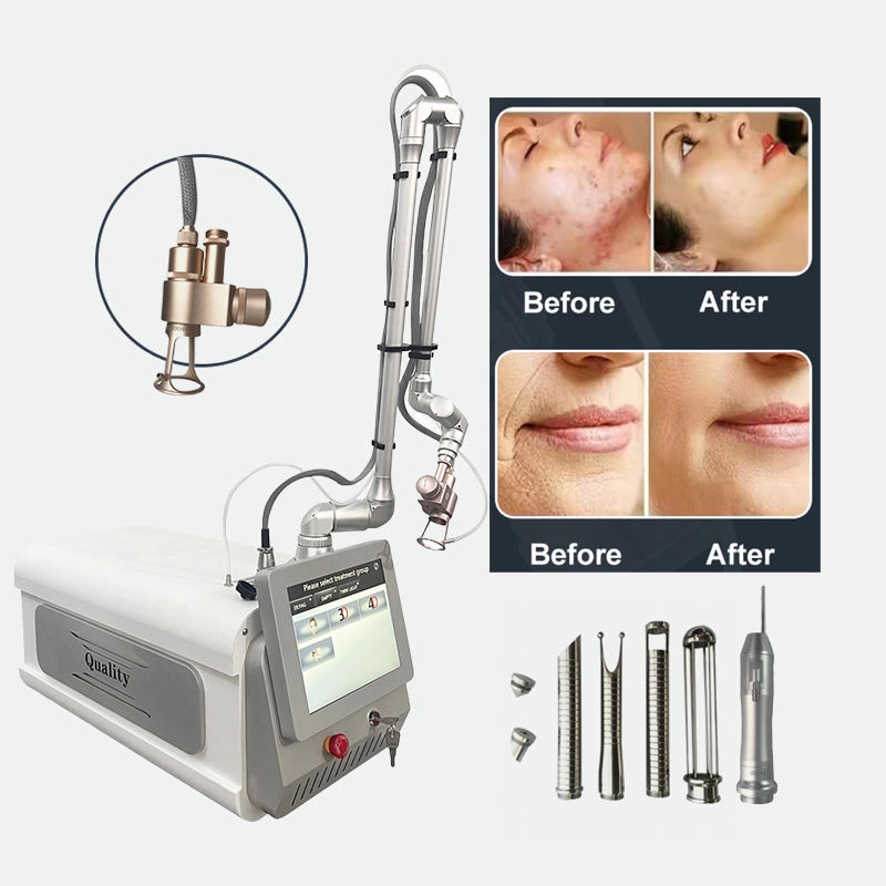 Fractional CO2 laser machine for skin resurfacing and acne scar treatment with before and after results. - HUIMAIN