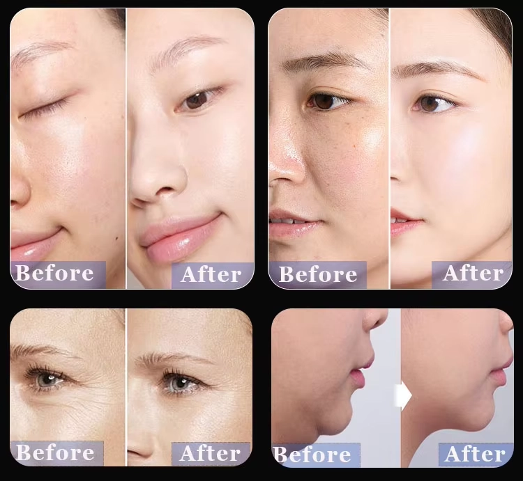 Before-and-after images demonstrating skin improvement and anti-aging effects. - HUIMAIN