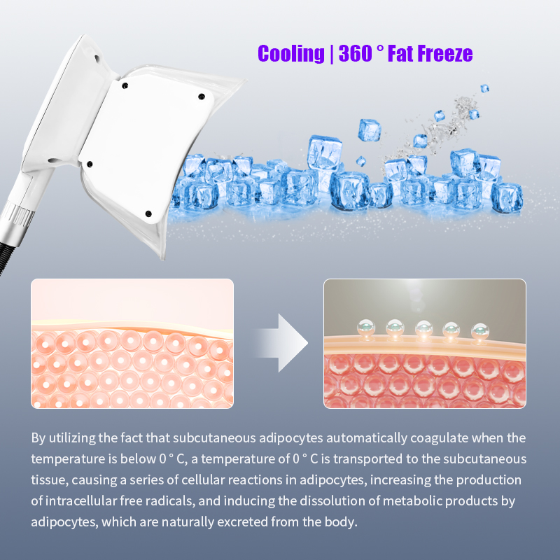 5 ems+cryo machine for body contouring 5 ems+cryo machine for body contouring