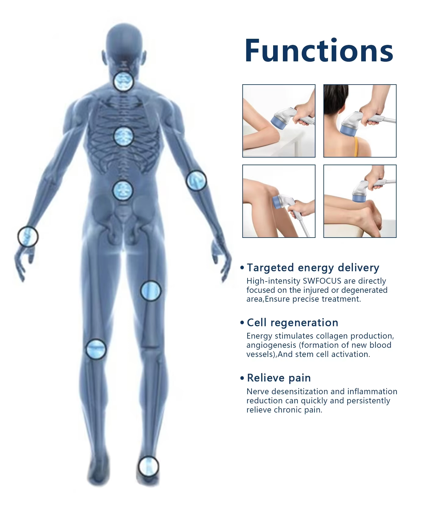 Ilustración de las áreas y funciones de tratamiento de SWFOCus - HUIMAIN