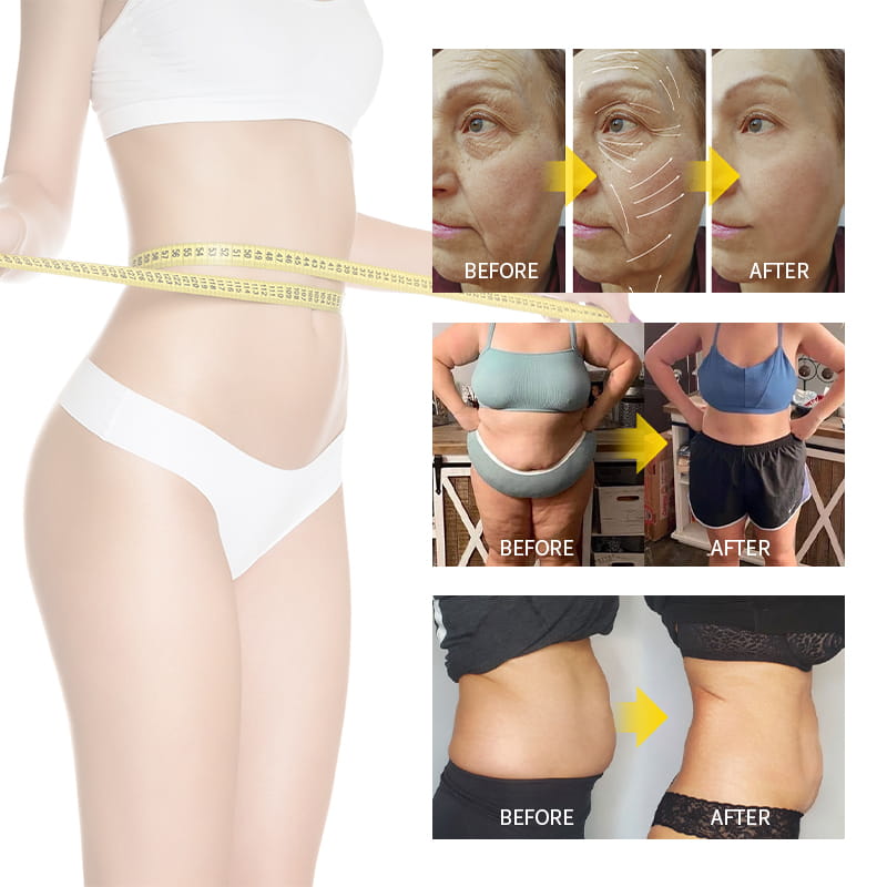 6-in-1Beauty and Weight Loss Machine