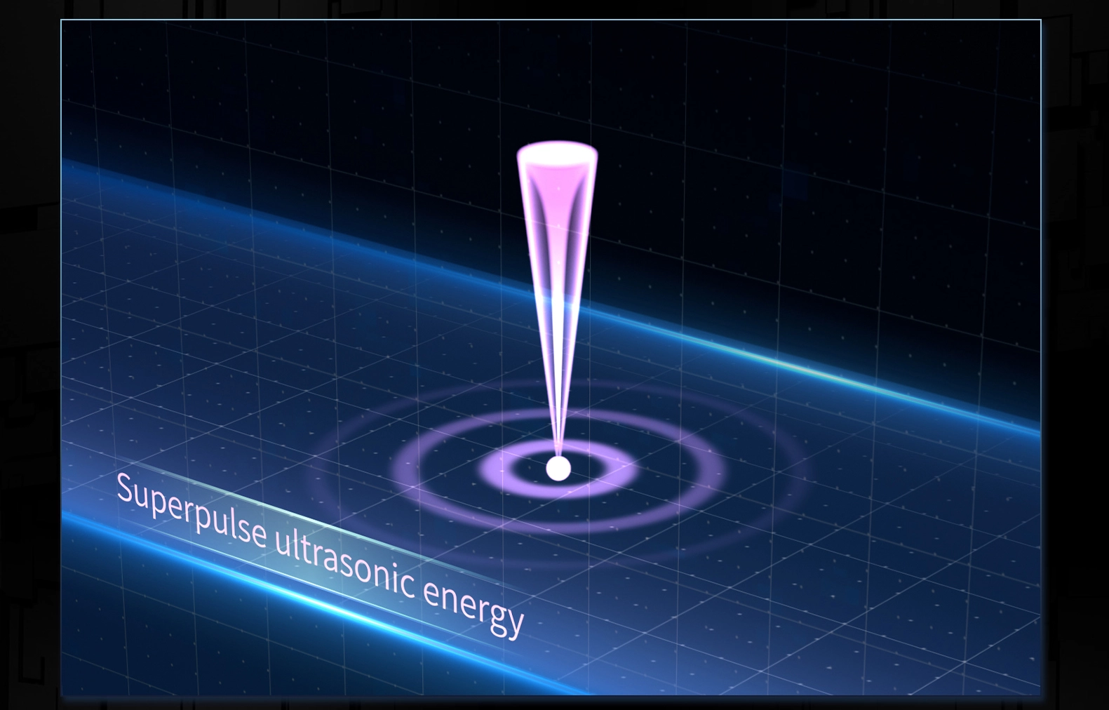 Illustration of Superpulse Ultrasonic Energy. - HUIMAIN