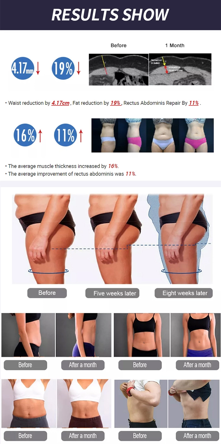 7 Tesla EMS machine for deep muscle contractions - HUIMAIN