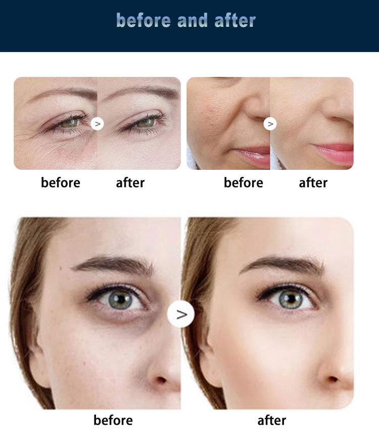 Skincare before and after images showing reduced wrinkles and dark circles. - HUIMAIN