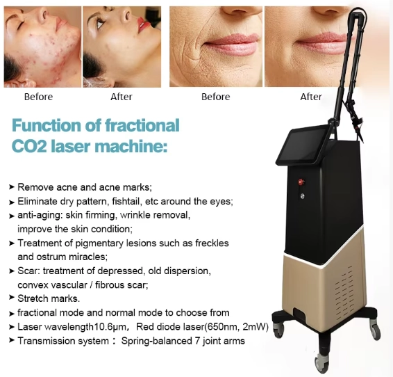 Before and after: CO2 fractional laser machine results. - HUIMAIN