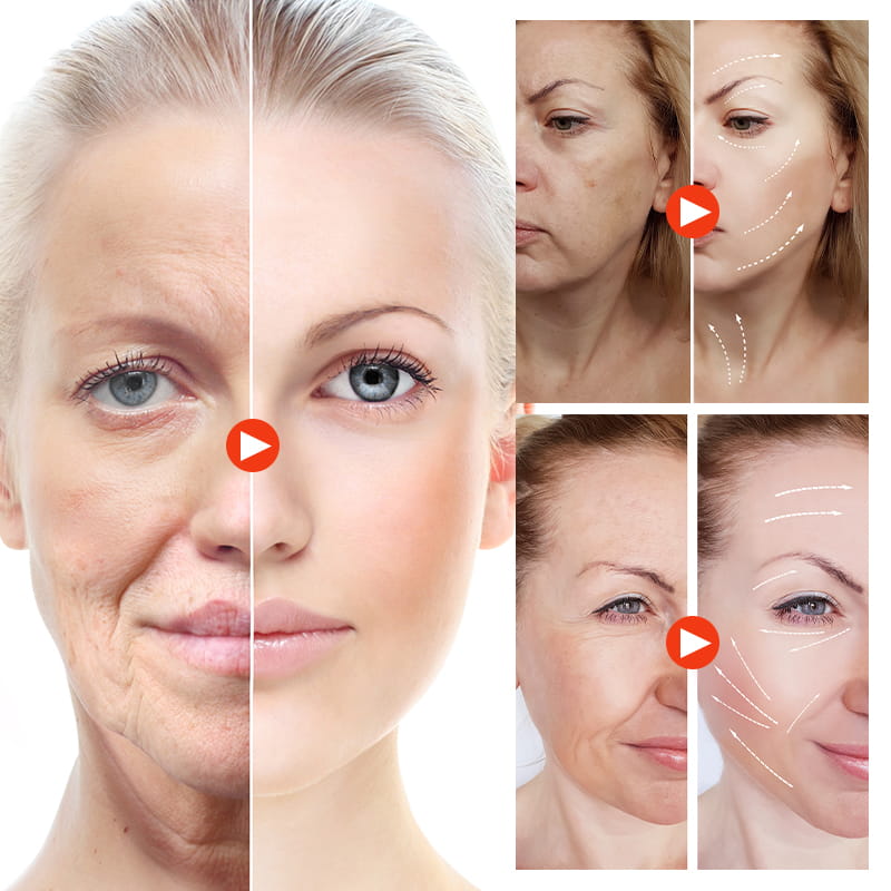 7D HIFU Machine (9) 7D HIFU Machine (9)