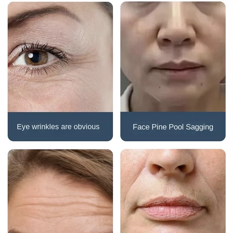 Four close-up photos demonstrating signs of aging on skin, including wrinkles around the eye, sagging skin around the mouth, forehead wrinkles, and facial wrinkles. - HUIMAIN