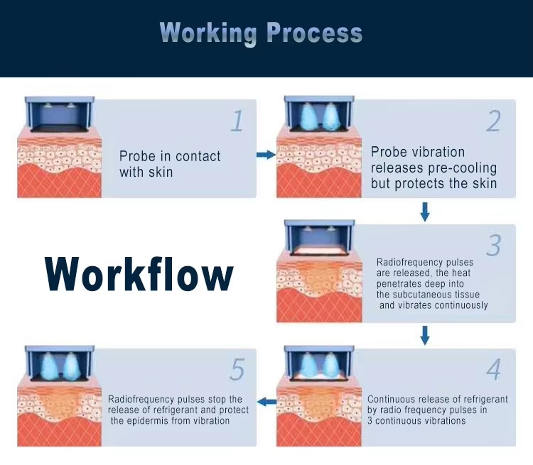 Diagram of the Radiofrequency Treatment Workflow. - HUIMAIN