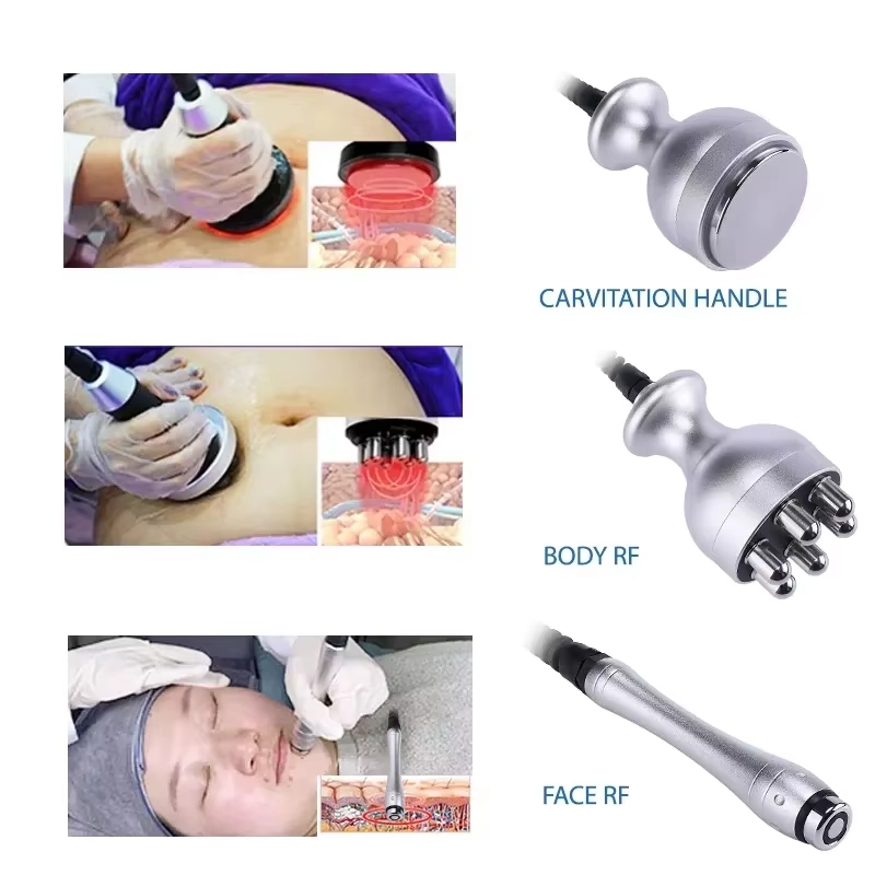 Image illustrating cavitation, body radio frequency, and facial radio frequency treatments. - HUIMAIN