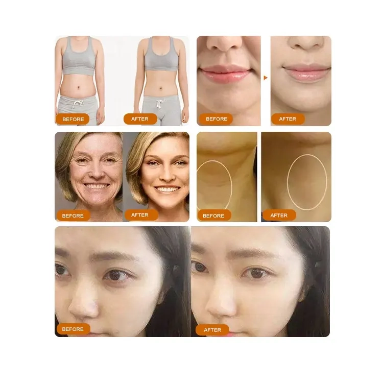Cosmetic procedure before-and-after photo compilation. - HUIMAIN