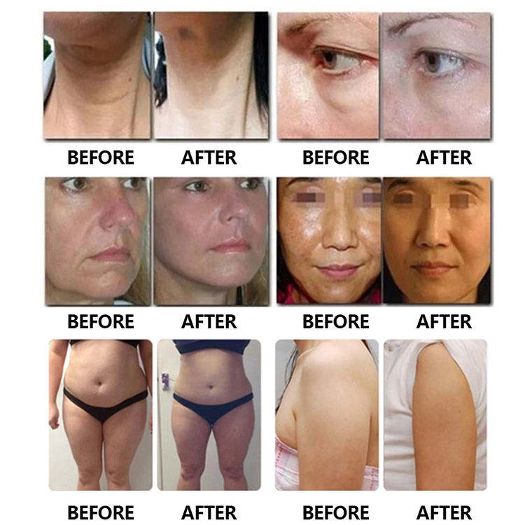 Before and after images showing various cosmetic procedure results. - HUIMAIN