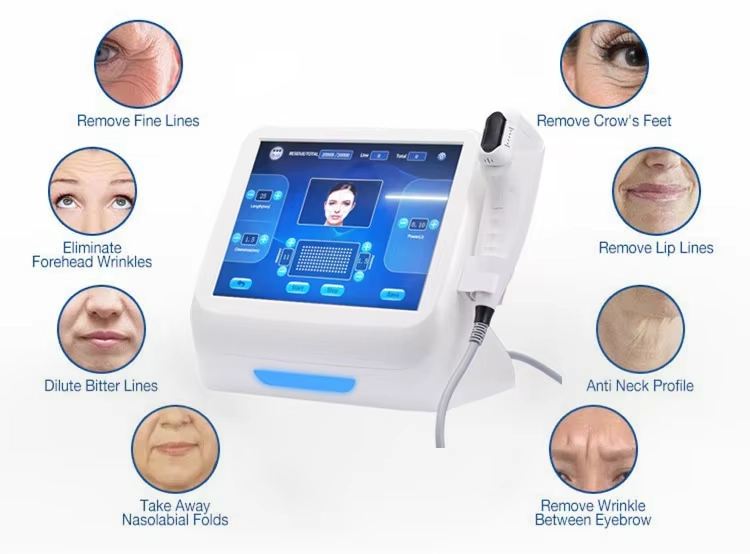 HIFU facial machine demonstrating anti-aging treatments for fine lines, crow's feet, forehead wrinkles, lip lines, bitter lines, nasolabial folds, neck wrinkles, and wrinkles between eyebrows. - HUIMAIN
