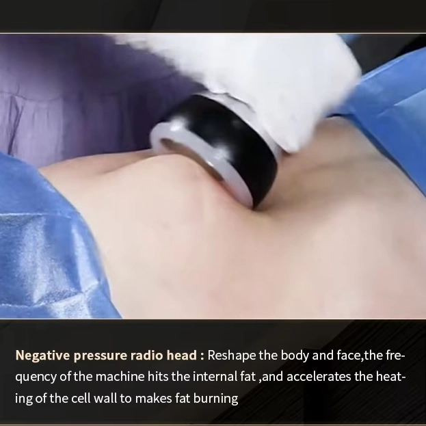 Radio frequency treatment for fat reduction on a patient's abdomen. - HUIMAIN