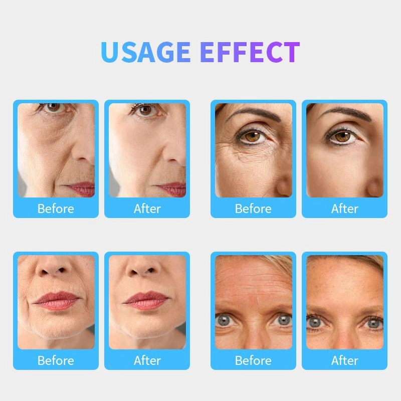 EMS facial treatments - HUIMAIN