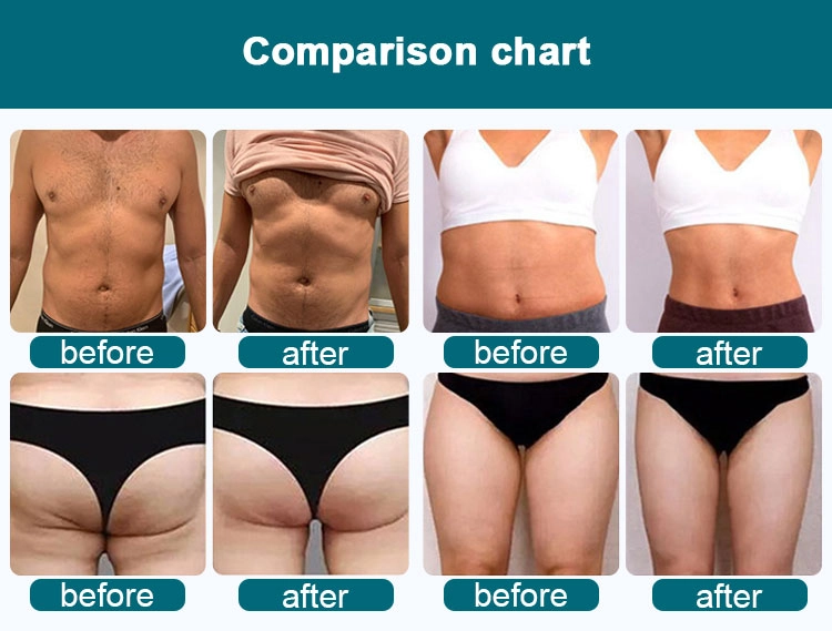 Emslim neo portable body sculpting machine for professional use - HUIMAIN