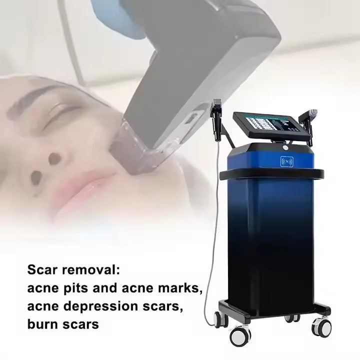 Facial scar removal treatment using advanced aesthetic technology. - HUIMAIN