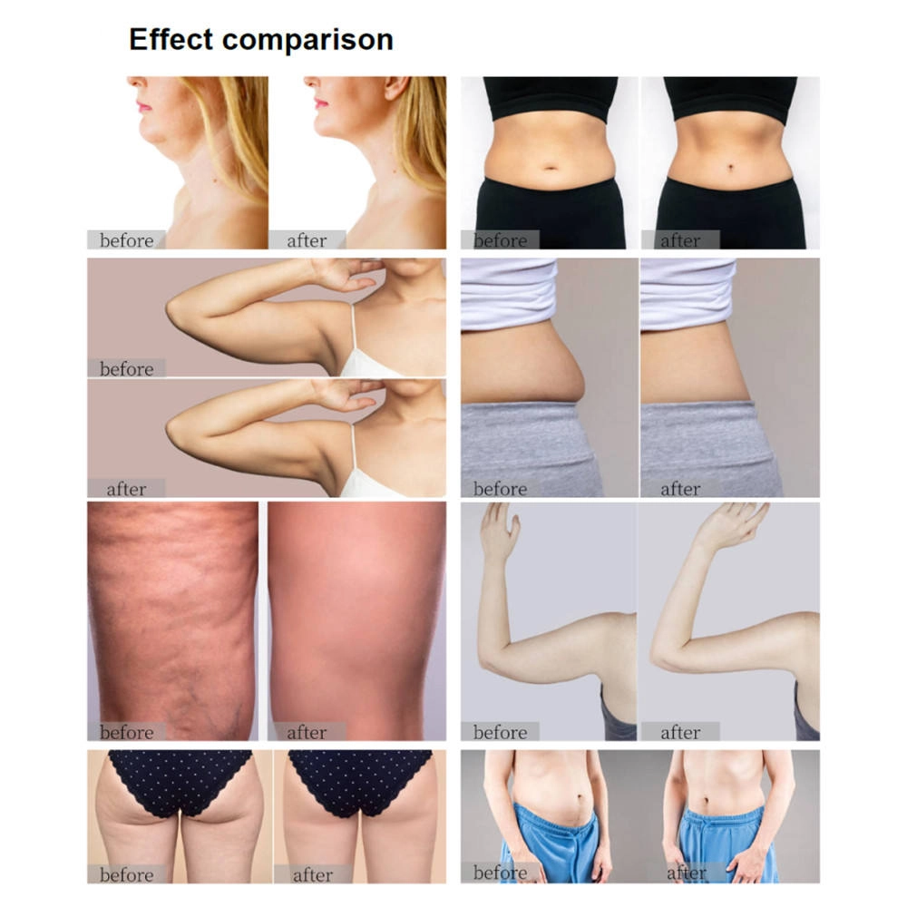 Before and after image showing body contouring results on various areas like neck, stomach, arms, thighs, and waist. - HUIMAIN