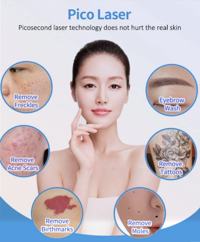 Pico laser treatment for skin conditions including freckles, acne scars, birthmarks, moles, tattoos and eyebrow wash. - HUIMAIN