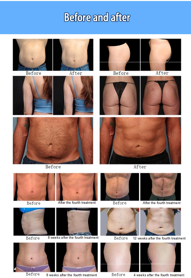 High-intensity-EMS-muscle-building-and-fat-burning-machine - HUIMAIN High intensity EMS muscle building and fat burning machine - HUIMAIN