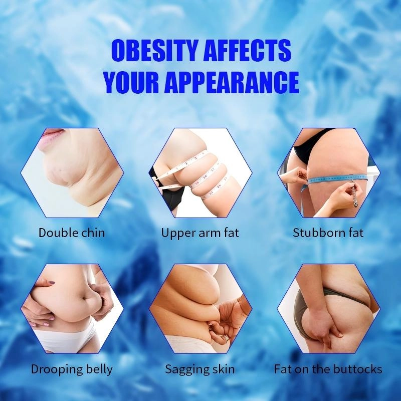 Huimain Cryolipolysis - HUIMAIN