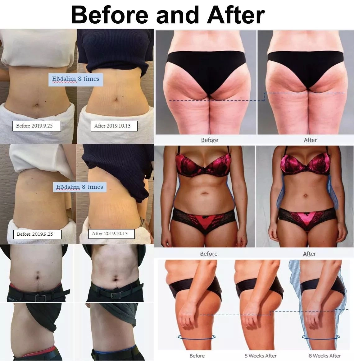Intelligent-body-sculpting-system-with-EMS-and-RF-technology - HUIMAIN Intelligent body sculpting system with EMS and RF technology - HUIMAIN