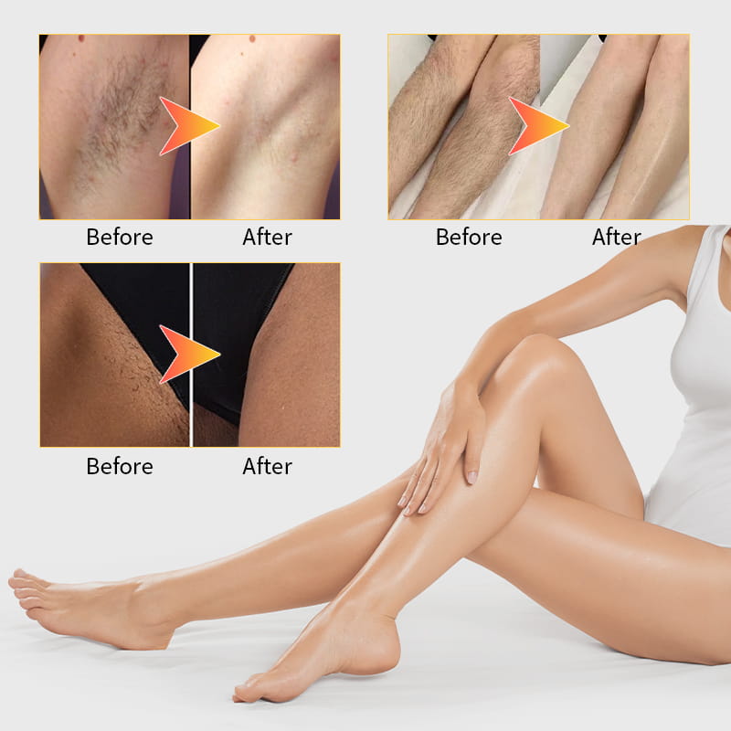 Laser Hair Removal Machine (9)