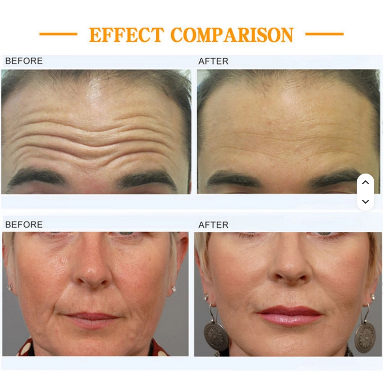 Multifunctional magnetic face machine for anti-aging treatments. - HUIMAIN Multifunctional magnetic face machine for anti-aging treatments. - HUIMAIN