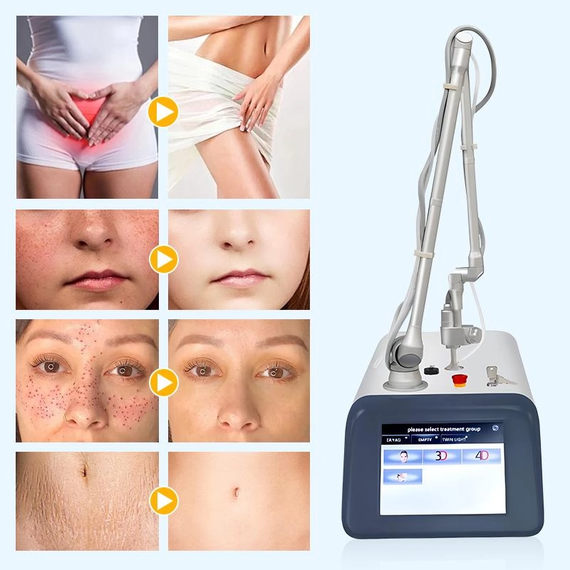 Non-Invasive Treatment - HUIMAIN