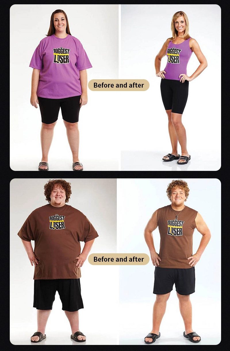 Máquina de reducción de grasa no quirúrgica con interfaz de operación inteligente - HUIMAIN Máquina de reducción de grasa no quirúrgica con interfaz de operación inteligente - HUIMAIN