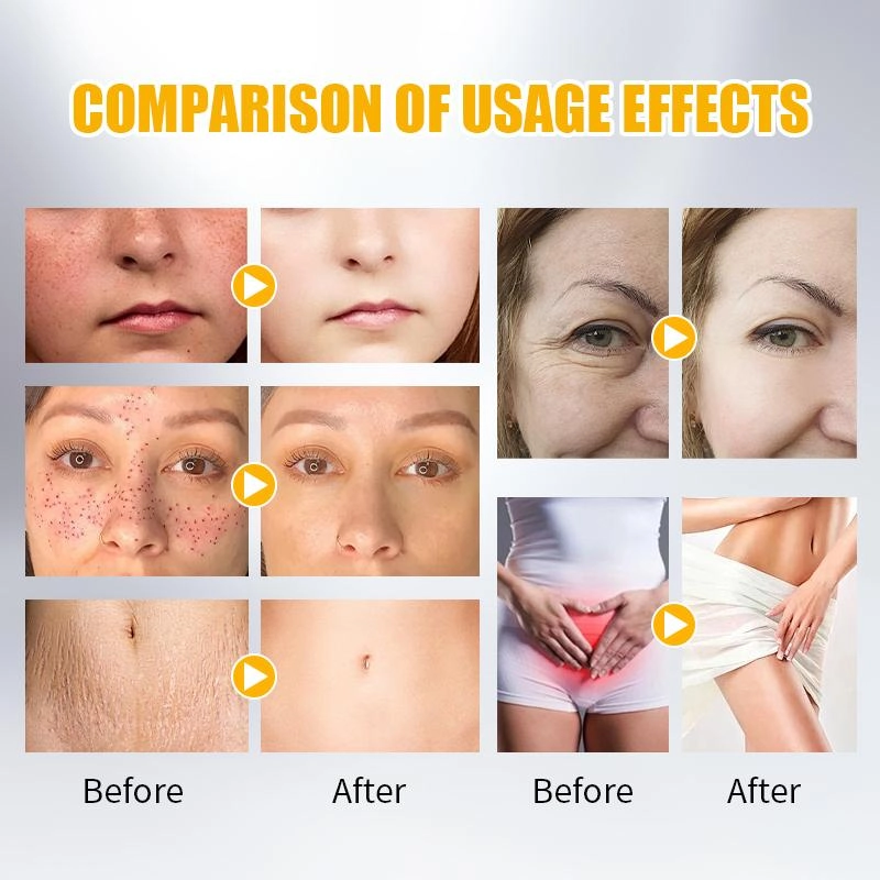 Post-Treatment Care and Recovery - HUIMAIN