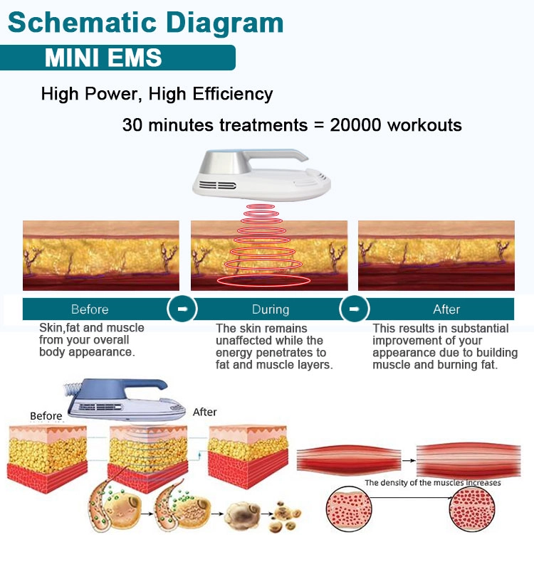 Professional EMS fat reduction and muscle strengthening equipment - HUIMAIN