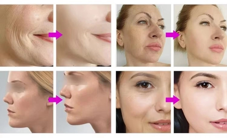 Professional salon use beauty device with cooling and heating modes - HUIMAIN