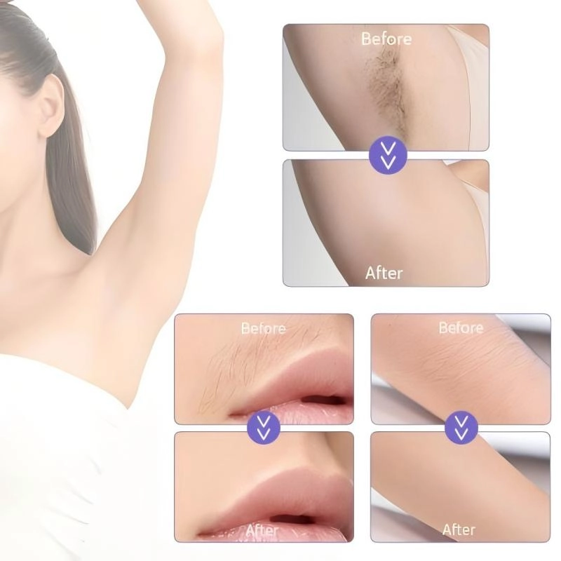 Beneficios del tratamiento2 - HUIMAIN