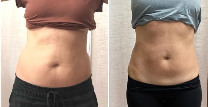 Equipo TruFat para quemar grasa y tonificar los músculos - HUIMAIN Equipo TruFat para quemar grasa y tonificar los músculos - HUIMAIN