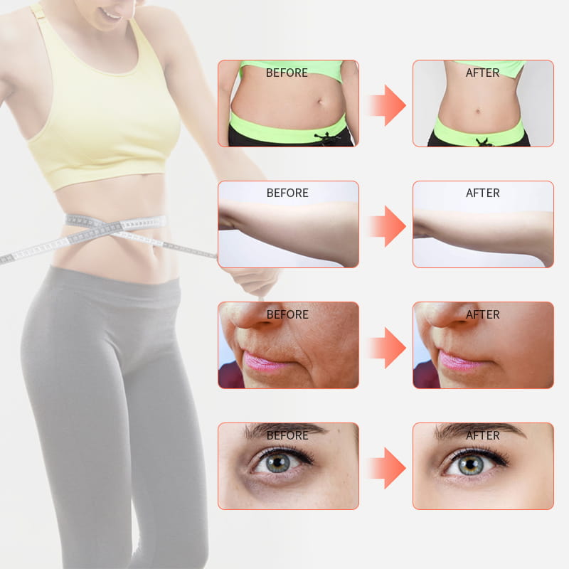 V9 Slimming Machine V9 Slimming Machine